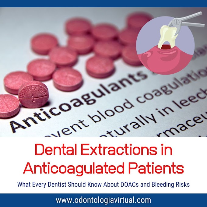 PDF: Dental Extractions in Anticoagulated Patients: What Every Dentist Should Know About DOACs and Bleeding Risks