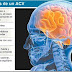 Terapia con células madre para el tratamiento de ACV