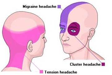 SHARING IS CARING: kepala sakit VS sakit kepala