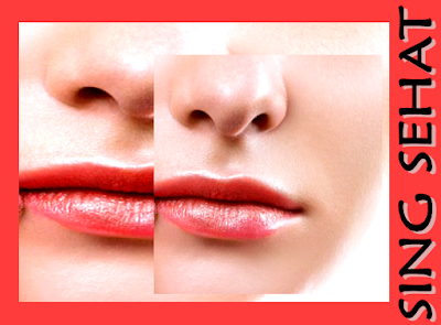 Mengeksfoliasi  berarti kau merontokkan sel kulit mati dari bibir dan menciptakan  peredaran  Begini Cara sehat semoga bibir terlihat pink