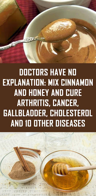The Doctors Have no Explanation for This: Just Boil Cinnamon and Honey and Treat Arthritis, Cancer, Cholesterol, Cold, Flu, Lose Weight and 10 Other Diseases!