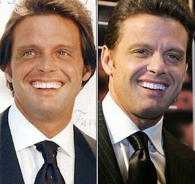 El Antes y Despues de la Estrellas - Luis Miguel