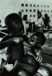 Foto Jutaan Anak Tewas Kelaparan Karena Perang Biafra [ www.BlogApaAja.com ]