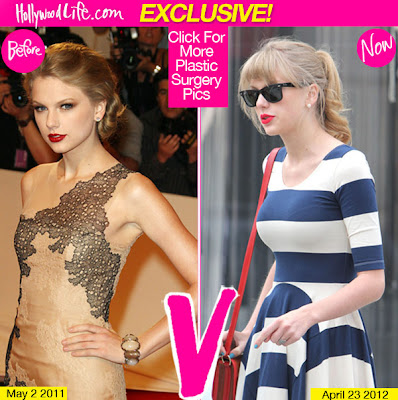 Taylor Swift Got Breast Implants See Her Before And After click for more