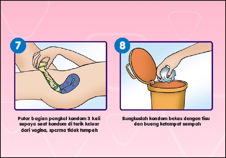 Catatan Liza Mengenal Kondom Wanita Female Condom 