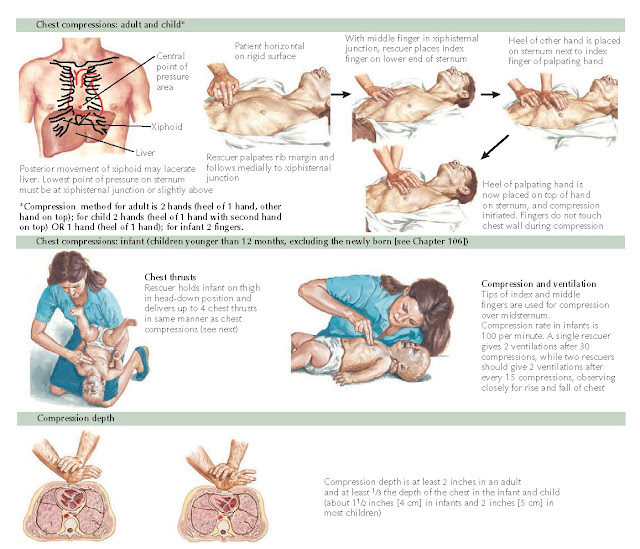 Figure 1-7 External chest compressions.