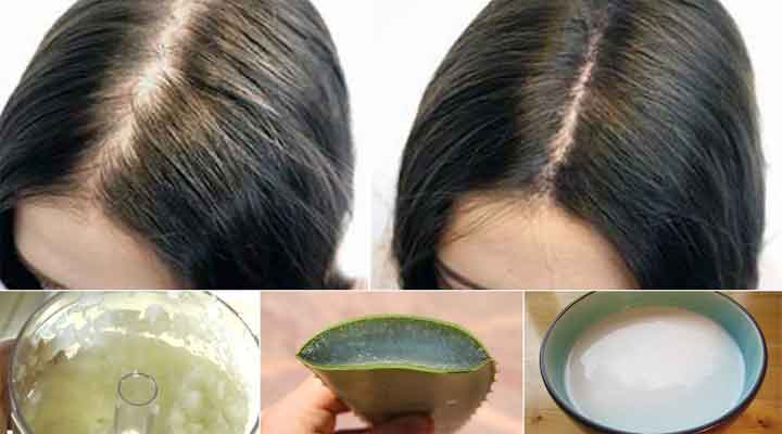 Tips To Cure Hair Fall Naturally