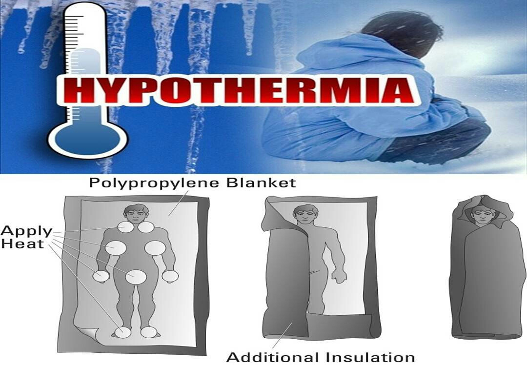 Cara Mengatasi Hypothermia di Pendakian - VIApendaki