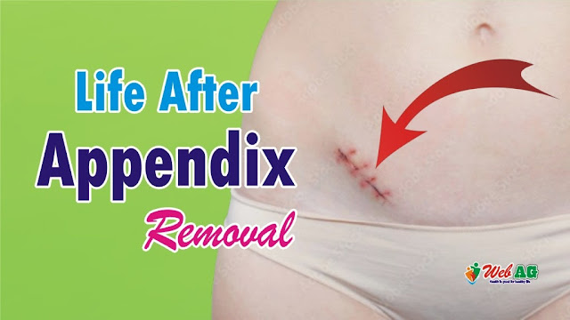 Life After Appendix Removal | Life After Appendix Surgery