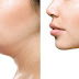 How To Reduce Double Chin Fat at home Without Undergoing Surgery?