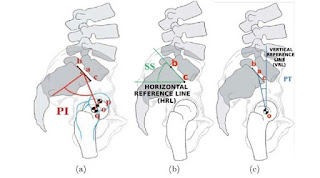 Pathologies of the Vertebral Column