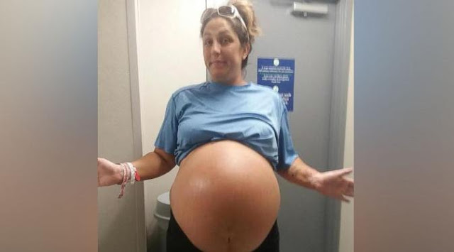 Lahirkan Bayi Seberat 6 Kilogram, Wanita Ini Kapok Punya Anak