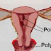 Trong chu kỳ kinh nguyệt, nội mạc tử cung có những gì thay đổi?