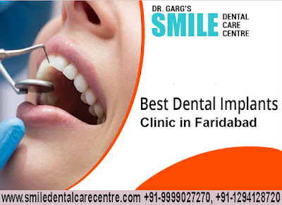 Dental Implants Treatment In Faridabad