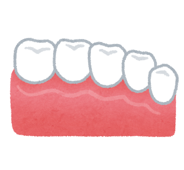 無料イラスト かわいいフリー素材集 セラミックの歯のイラスト 歯の治療