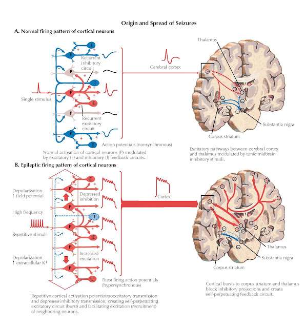 NORMAL ELECTRICAL FIRING PATTERNS OF CORTICAL NEURONS AND THE ORIGIN AND SPREAD OF SEIZURES