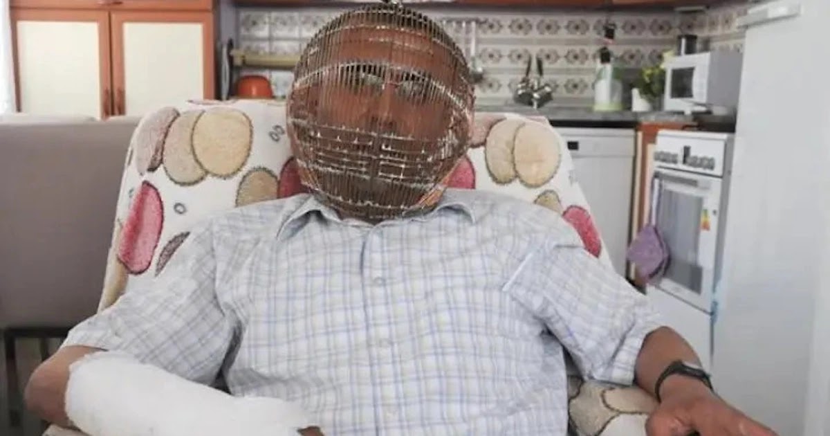 Man In Turkey Locks His Head In A Cage In Order To Quit Smoking