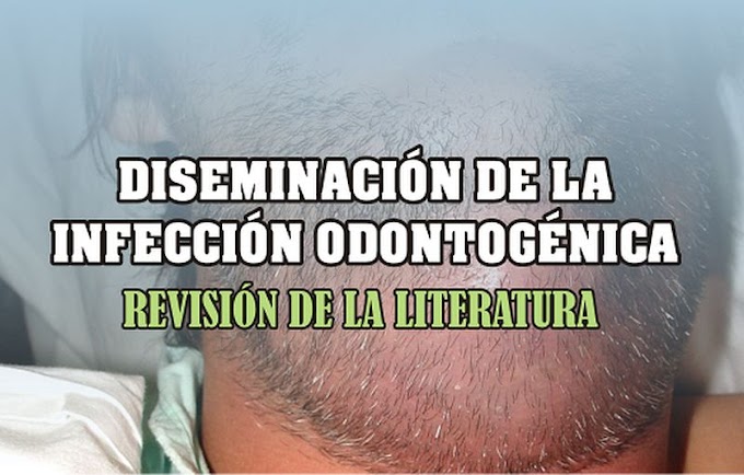 INFECCIÓN ODONTOGÉNICA: Diseminación - Revisión de la literatura