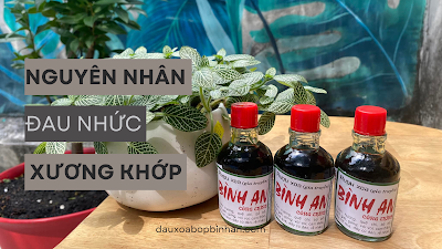 Những Nguyên Nhân Đau Nhức Xương Khớp Có Thể Bạn Chưa Biết