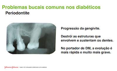 periodontite, diabetes, doenças comuns