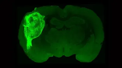 Pesquisadores transplantaram um organoide do cérebro humano (verde brilhante) no cérebro de um filhote de rato recém-nascido, criando um cérebro híbrido no qual os neurônios interagem. Crédito: Universidade de Stanford