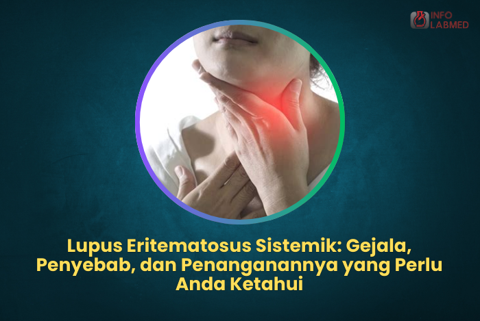 Lupus Eritematosus Sistemik Gejala, Penyebab, dan Penanganannya yang Perlu Anda Ketahui