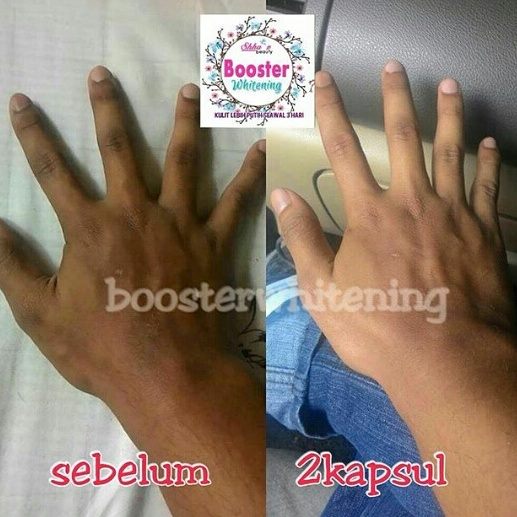 Booster Whitening: BOOSTER WHITENING MALAYSIA