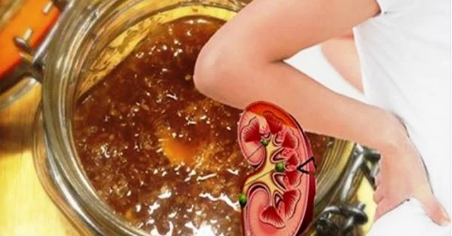 Two Teaspoons Of This Ancient Remedy A Day And You Can Forget About Colitis, Gastritis, Ulcers, Constipation And Kidney Stones!