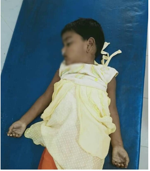 দিনাজপুরের বিরামপুরে পানির গ্লাসে শিশুকে এসিড খেতে দিল স্বর্ণকার