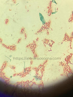 hasil pewarnaan endospora bakteri, bacterial endospore