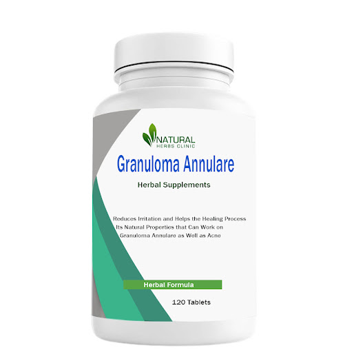 Best Treatment for Granuloma Annulare