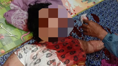  Polisi Berhasil Mengamankan Pelaku Pembacok Selingkuhan NR Di Cianjur