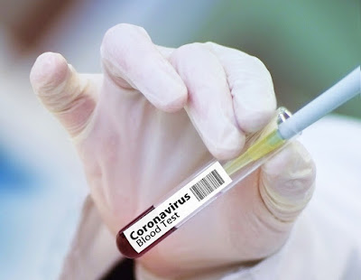 How to make a CORONA Vaccine