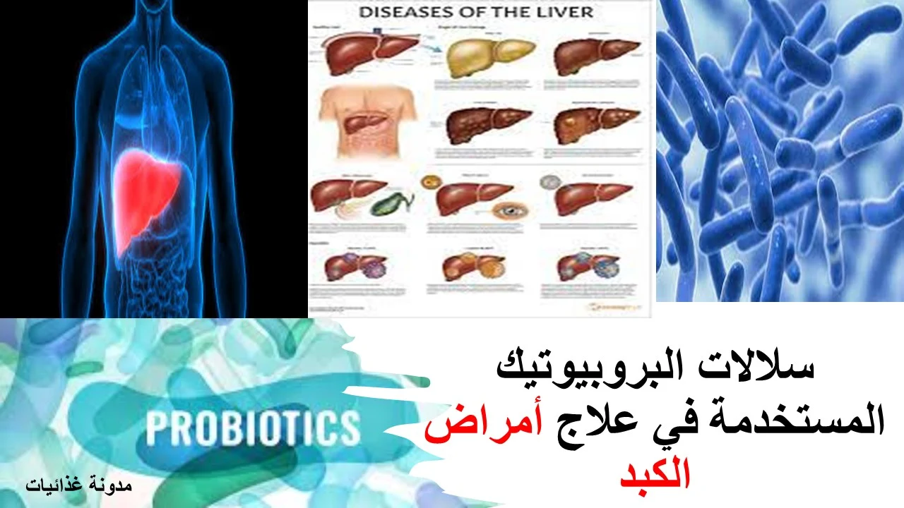 سلالات البروبيوتيك المستخدمة في علاج أمراض الكبد