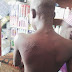 Photo: See what an Alfa allegedly did to a 13-year-old boy because he missed a class 