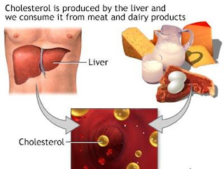 bagan penyebab kolesterol