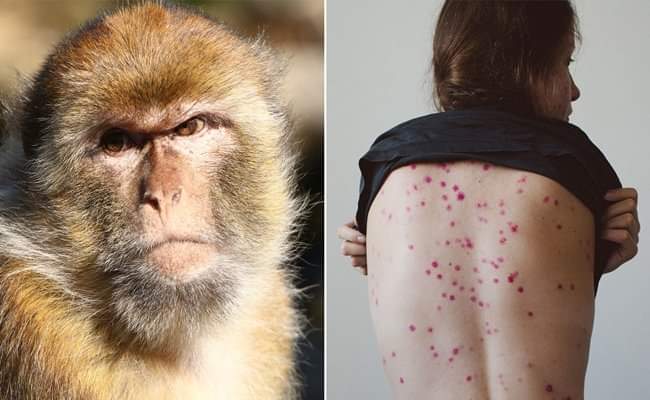 What is monkeypox What is monkeypox