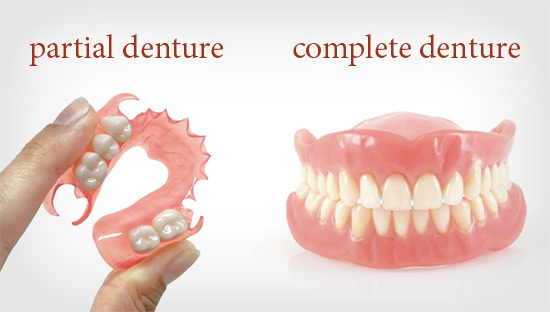 Your Ultimate Guide to Dentures and Tooth Replacement