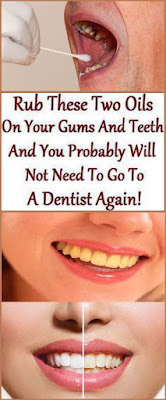 Rub These Two Oils On Your Gums And Teeth And You Probably Will Get Strong Teeth