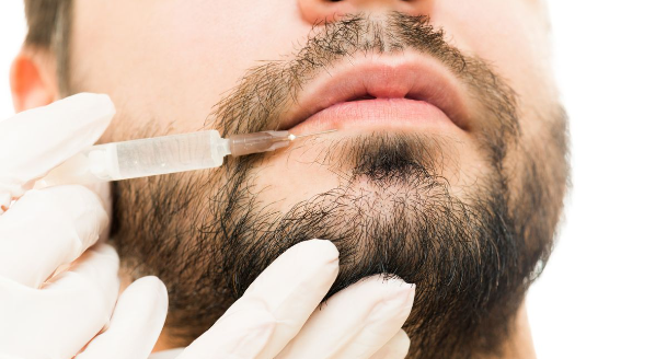 botox around the mouth