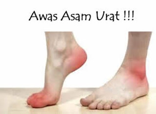 penyakit asam urat di usia muda, gambar tangan asam urat, asam urat makan jengkol, asam urat vs terong, asam urat apakah bisa sembuh, obat darah asam urat, menurunkan asam urat dengan alami, cara menghilangkan rasa nyeri pada asam urat, bayam penyebab asam urat, asam urat makanan tidak boleh, normal asam urat kolesterol dan gula darah, tips mengobati penyakit asam urat secara alami, gambar asam urat dalam darah, obat asam urat alami yang mujarab, obat herbal asam urat saat hamil, gejala asam urat di bahu, menu sehat asam urat dan kolesterol, asam urat yang tinggi, asam urat pantangan dan obatnya, tips mencegah penyakit asam urat, foto penderita asam urat, obat buat penyakit asam urat, nama generik asam urat, obat yg ampuh untuk penyakit asam urat, asam urat zaitun, harga obat asam urat di apotik, cek asam urat yg normal, asam urat hembing, asam urat yang normal untuk perempuan, asam urat hi