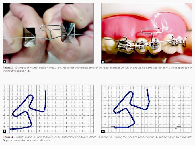 PDF: The T-loop in details