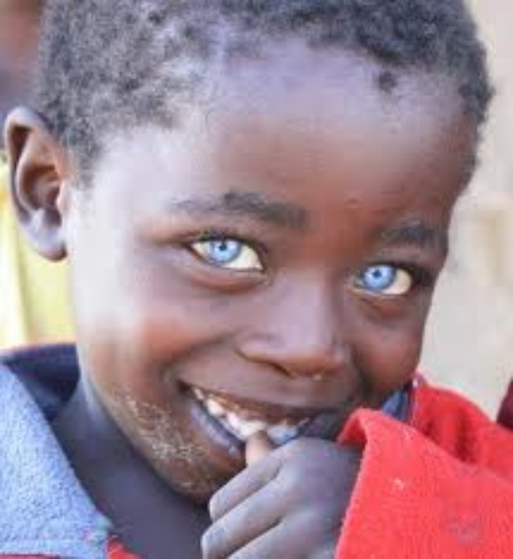 African People With Blue Eyes