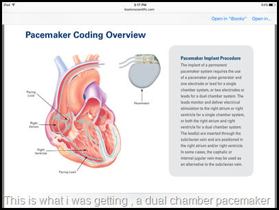 heart diagram