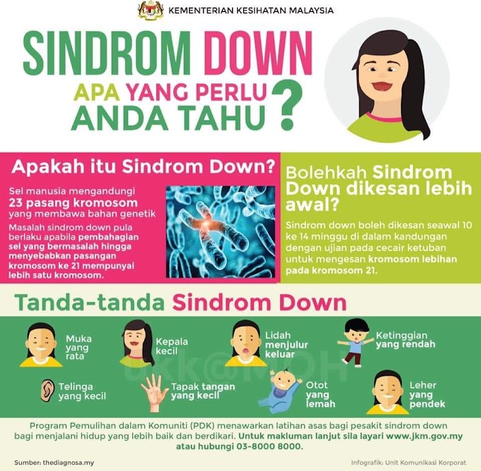 Sindrom Down - Apa Yang Perlu Anda Tahu 