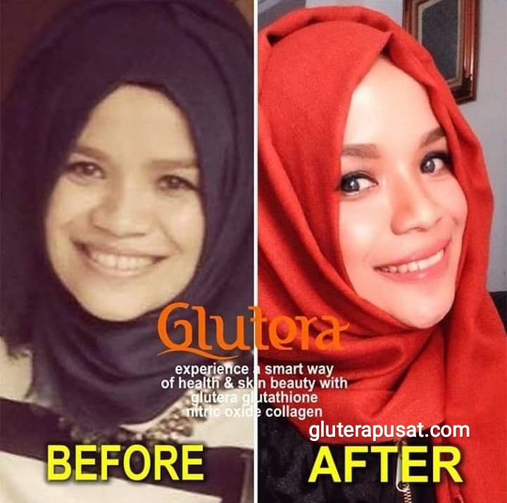 Testimoni Glutera Surabaya