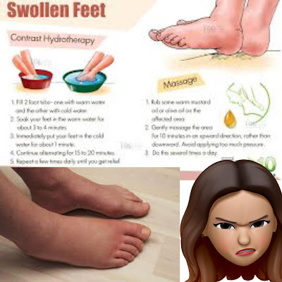 What’s inflicting those swollen feet.? But they could indicate a health condition.