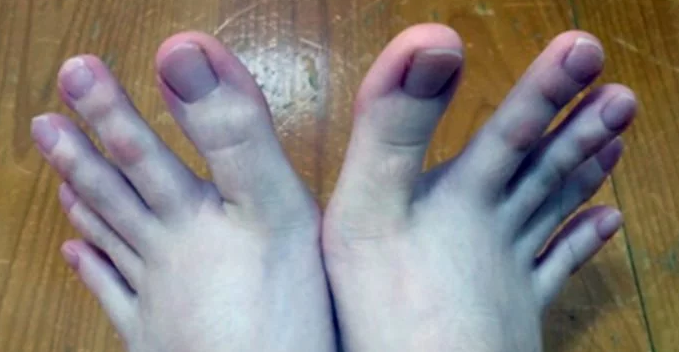 Everyone Is Obsessed With This Woman's Feet, Here's Why