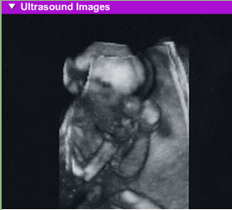 fetal development 6th month usg