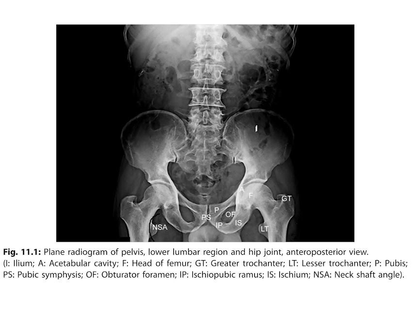 X-Rays of lower limb